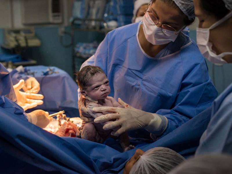 Caesarean Delivery in Baer Pune